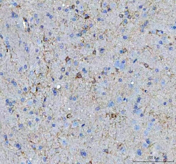 IHC staining of FFPE rat brain tissue with MIF antibody. HIER: boil tissue sections in pH8 EDTA buff