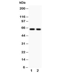 Western blot testing of TGFBR2 antibody and Lane 1: HEPG2; 2: COLO320. Expected molecular weight ~65