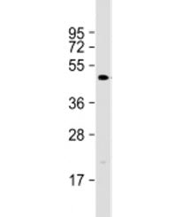 Western blot testing of human SW480 cell lysate with DEDD2 antibody at 1:1000. Predicted molecular w