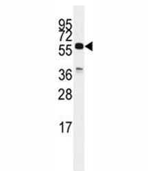 Western blot analysis of CDC25C antibody and K562 lysate. Expected molecular weight: ~53/60 kDa (unm