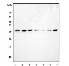 Galectin 3 Antibody