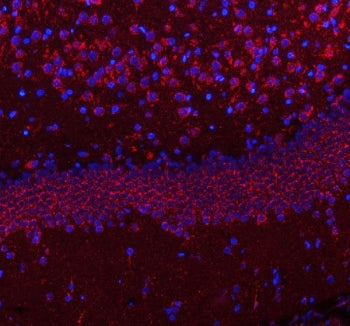 Immunofluorescent staining of FFPE rat brain tissue with HCRT antibody (red) and DAPI nuclear stain 