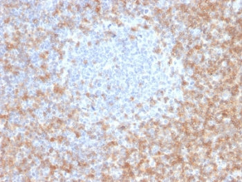 IHC staining of FFPE human tonsil with CD5 antibody (clone CD5/2416). Required HIER: boil tissue sec