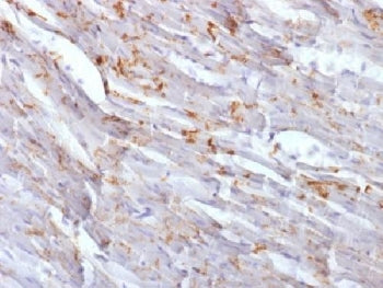 N-Cadherin Antibody / CDH2