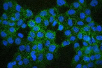 Immunofluorescent staining of FFPE human A431 cells with COMT antibody (green) and DAPI (blue). HIER