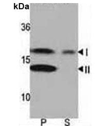 Western blot analysis of LC3 antibody and rat brain lysate: Both lipidated (arrow, II) and non-lipid