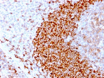 IHC staining of FFPE human tonsil tissue with recombinant CD79b antibody (clone IGB/3170R). HIER: bo