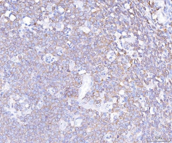 IHC staining of FFPE human tonsil tissue with PLCG2 antibody. HIER: boil tissue sections in pH8 EDTA