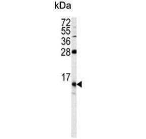 Western blot testing of human HEK293 cell lysate with FKBP1B antibody. Predicted molecular weight ~1