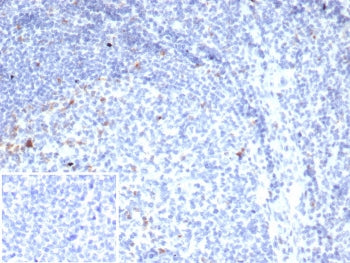 IHC staining of FFPE human tonsil tissue with CTLA4 antibody (clone rCTLA4/7219). Inset: PBS used in