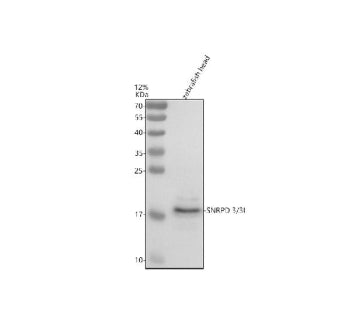 Western blot analysis of Snrpd3/3l protein using Zebrafish Snrpd3 antibody and zebrafish head tissue