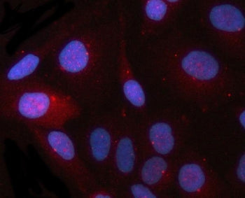 Immunofluorescent staining of FFPE human HeLa cells with CEP164 antibody (red) and DAPI nuclear stai