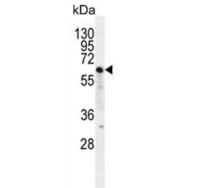 Western blot testing of human Jurkat cell lysate with NKD2 antibody. Expected molecular weight: 50-6