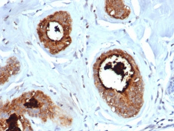 IHC staining of FFPE human lactating breast tissue with recombinant Mammaglobin A antibody (clone rM