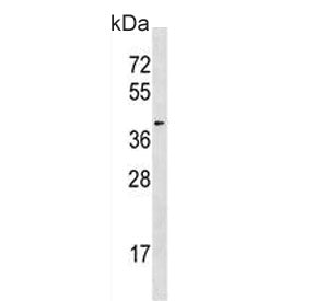 Western blot testing of human Jurkat cell lysate with HDAC11 antibody. Predicted molecular weight ~3