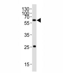 SMAD1 Antibody