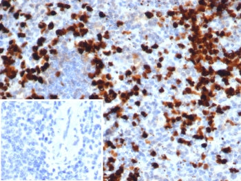 IHC staining of FFPE human spleen tissue with MRP14 antibody (clone S100A9/7547). Inset: PBS used in