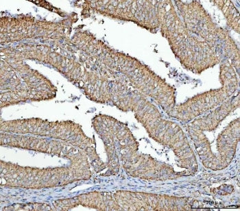 RPS13 Antibody / Small ribosomal subunit protein uS15