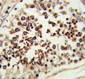 IHC testing of FFPE human testis tissue with SMAC/Diablo antibody. HIER: steam section in pH6 citrat
