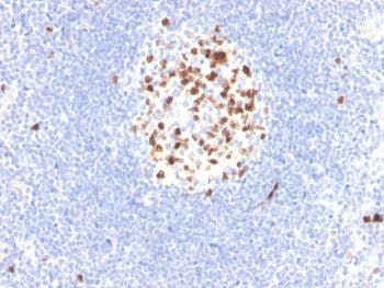 IHC staining of FFPE human lymph node with recombinant Topoisomerase II alpha antibody (clone rTOP2A