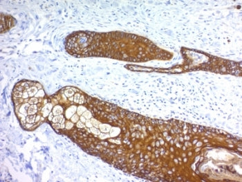 Basic Cytokeratin Antibody