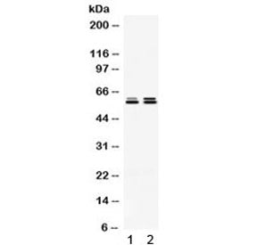 Western blot testing of 1) rat testis and 2) human HeLa lysate with TCP1 epsilon antibody. Expected 