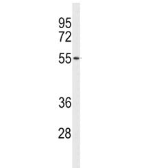 Western blot analysis of ACCN1 antibody and human NCI-H460 lysate. Predicted molecular weight ~58 kD