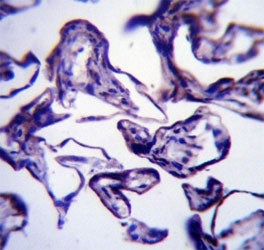 LEP antibody immunohistochemistry analysis in formalin fixed and paraffin embedded human placenta ti
