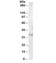 Western blot testing of mouse spleen lysate with BTLA antibody at 1ug/ml. Predicted molecular weight