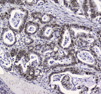 APE1 Antibody