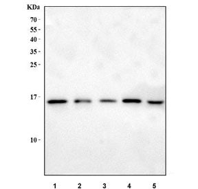 MYDGF Antibody / Myeloid-derived growth factor
