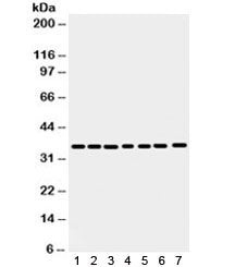 Western blot testing of 1) rat spleen, 2) rat stomach, 3) human HeLa, 4) 22RV1, 5) A549, 6) MCF7 and