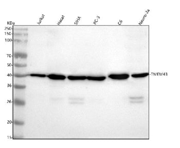 Western blot analysis of TMEM43 using anti-TMEM43 antibody. Lane 1: human Jurkat whole cell lysates,