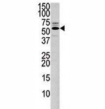 PTEN Antibody