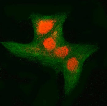Immunofluorescent staining of FFPE human A549 cells with RNF34 antibody (red) and Beta Tubulin mAb (