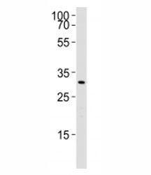 Cebpb Antibody