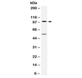 FGFR1 Antibody / Fibroblast growth factor receptor 1