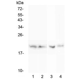 BCMA Antibody / CD269 / TNFRSF17