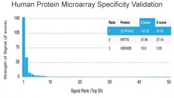 Analysis of HuProt(TM) microarray containing more than 19,000 full-length human proteins using Alpha