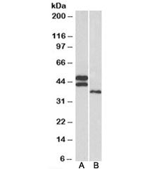 Western blot testing of human heart [A] and liver [B] lysates with FCRL1 antibody at 0.3ug/ml. Isofo