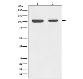 Western blot testing of human 1) Jurkat and 2) MCF7 cell lysate with Rb1 antibody. Predicted molecul