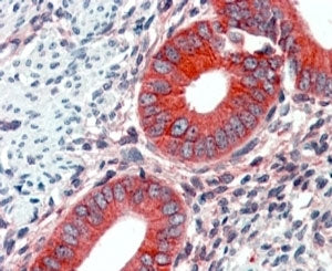 IHC testing of FFPE human uterus with EPB41L2 at 2ug/ml. HIER: steamed with pH6 citrate buffer, AP-s