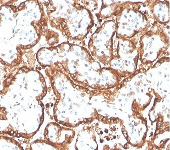 IHC staining of FFPE human placental tissue with HCGb antibody (HCGb/4709R). HIER: boil tissue secti