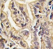 CSF1R Antibody
