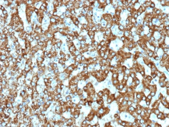 IHC staining of FFPE human liver tissue with recombinant EPH Receptor B4 antibody (clone EPHB4/9663R