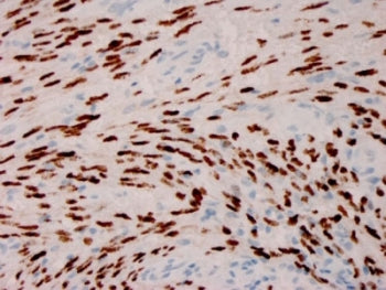 Herpes Virus 8 Antibody
