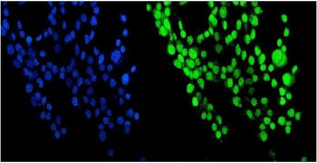 Immunofluorescent staining of FFPE human A431 cells with NUP214 antibody (green) and DAPI nuclear st