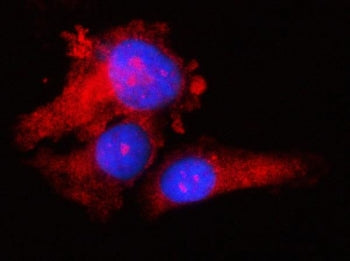 RPS17 Antibody / 40S ribosomal protein S17