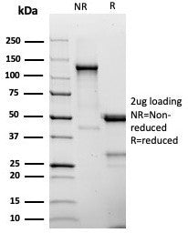 SDS-PAGE analysis of purified, BSA-free CD25 antibody (clone IL2RA/4375R) as confirmation of integri