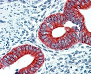 IHC staining of FFPE human uterus with EPB41L2 antibody at 2.5ug/ml. HIER: steamed with pH6 citrate 